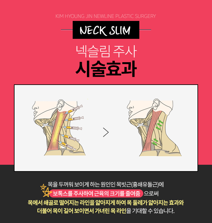 목라인 예쁘게 만들어주는 넥슬림주사 관련 이미지 4