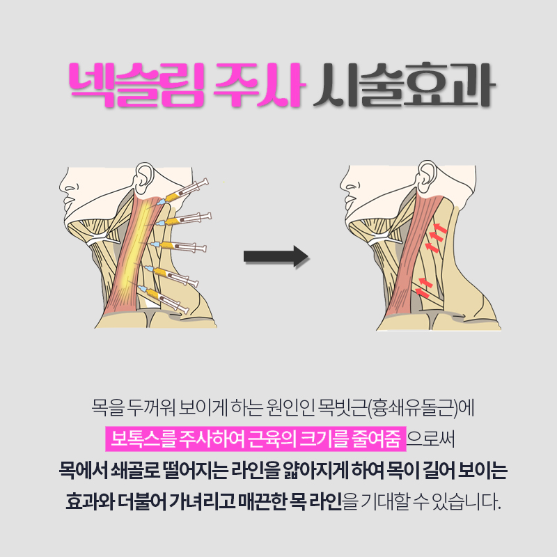 두꺼운목으로 강해보이는 인상이라면? 관련 이미지 4