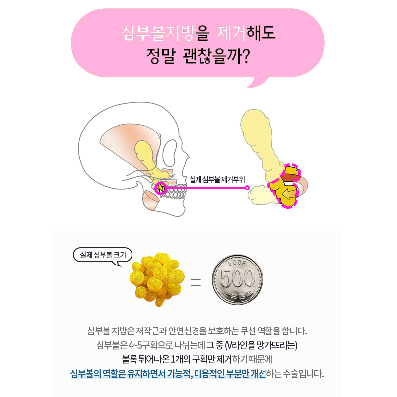 심부볼제거후기 직접 눈으로 보고 결정하세요 관련 이미지 4