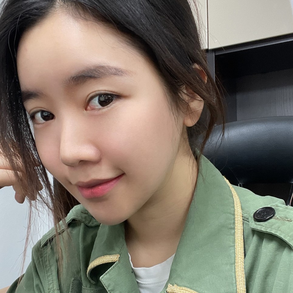 양악없이 빵떡 탈출한 얼굴지흡전후 관련 이미지 2