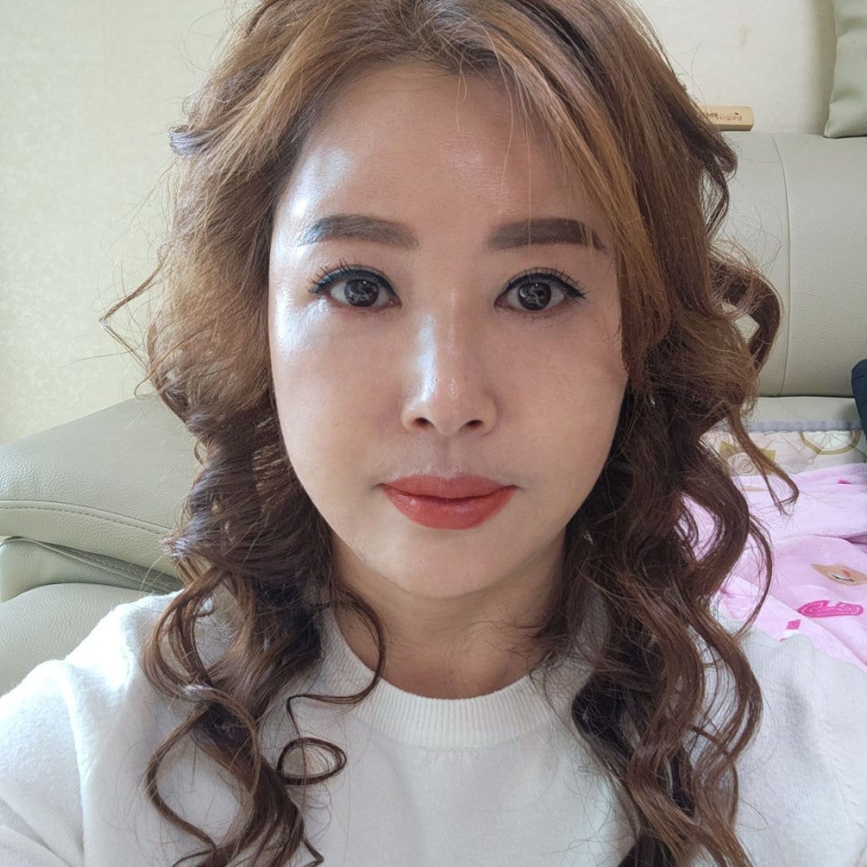 미니하안검전후 변화과정 확인하세요! 관련 이미지 2