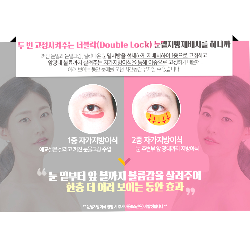 회복 빠른 눈밑지병원 찾고 있었다면 관련 이미지 4