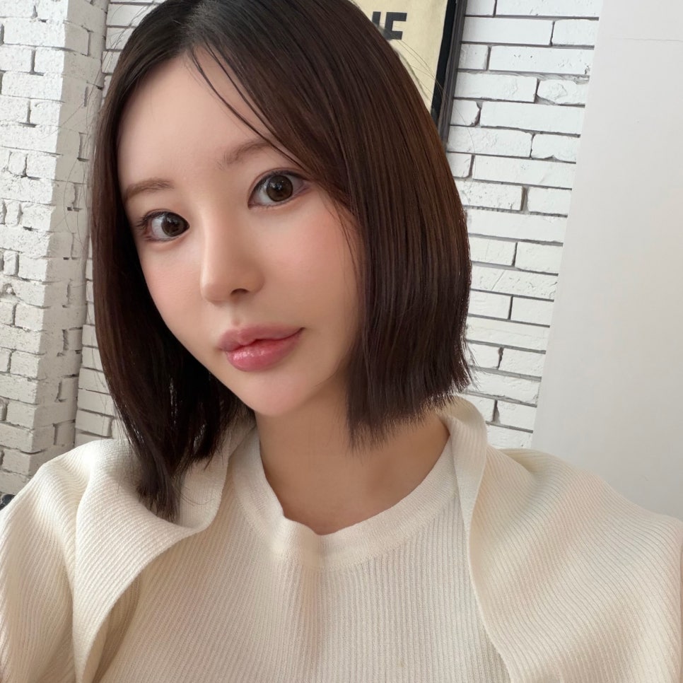 볼살제거 하고 V라인 장착하고 왔어요! 관련 이미지 3
