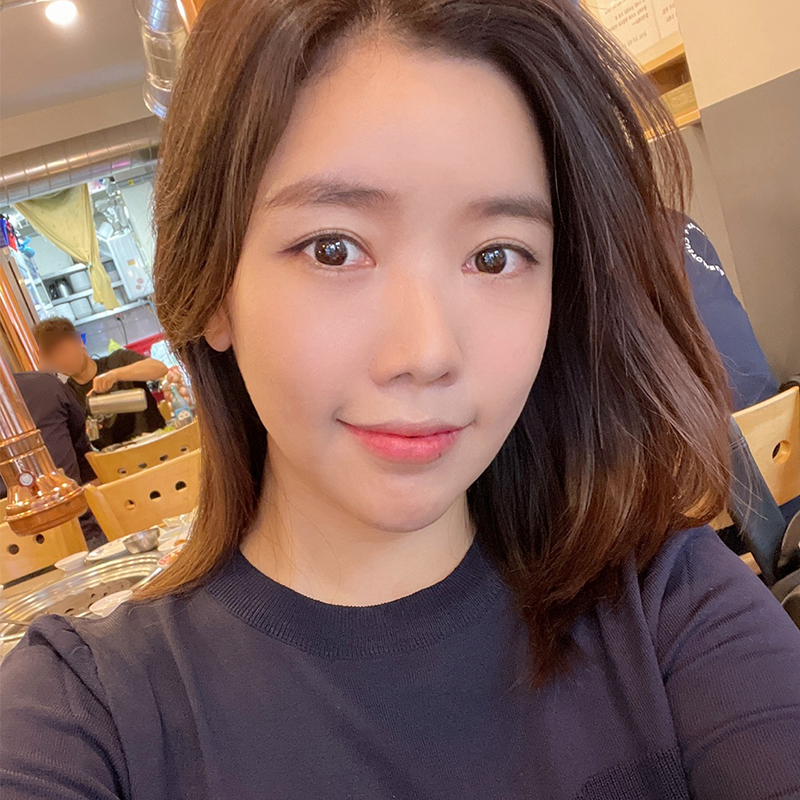 얼굴지방흡입부작용 걱정 되신다면 관련 이미지 2