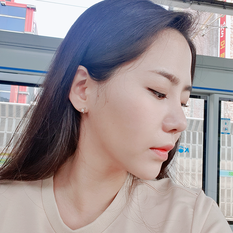 침샘보톡스효과 아직도 모르셨다면 관련 이미지 4