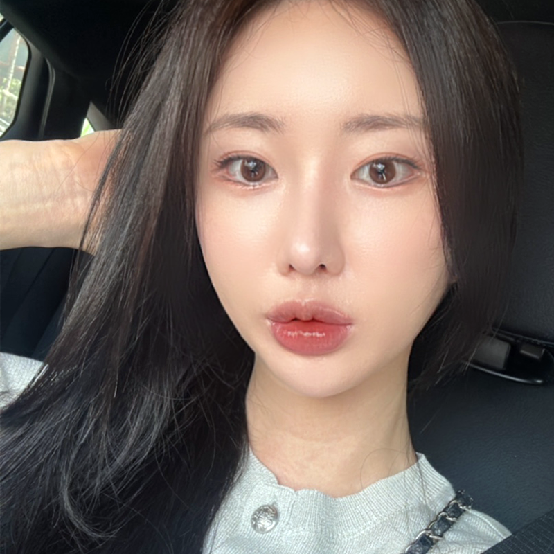 압구정눈밑지방재배치 여기로 오세요! 관련 이미지 1