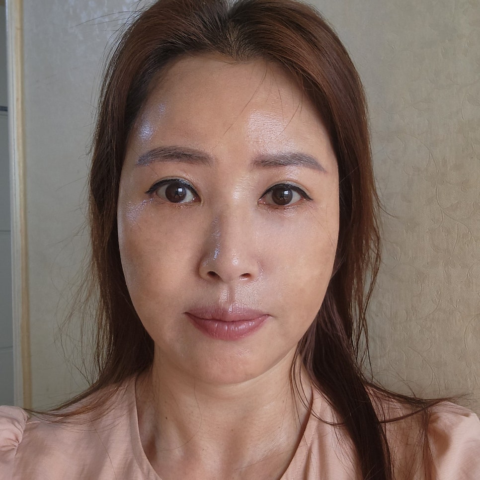 중년미니하안검으로 눈 밑 고민 해결했어요! 관련 이미지 1