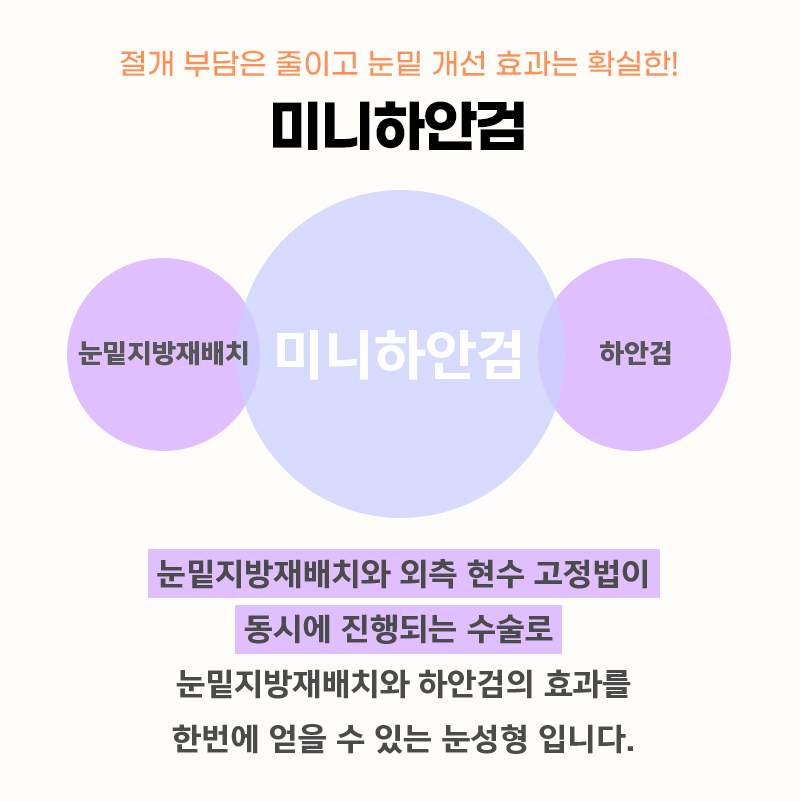 중년눈수술 걱정돼서 망설이고 있다면 관련 이미지 3