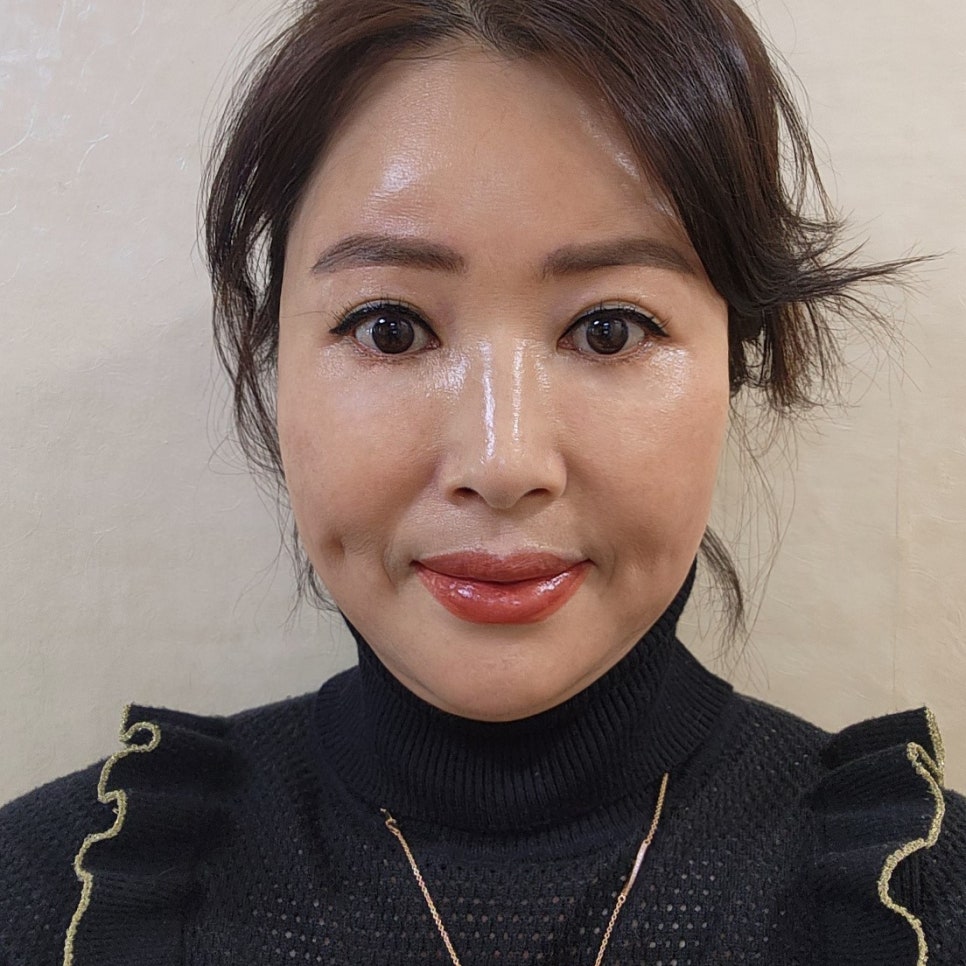중년눈밑수술전후 잘하는 곳에서 하면 확실히 달라요 관련 이미지 2