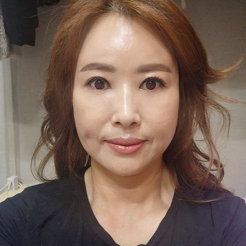 미니하안검흉터 걱정 되신다구요? 김형진베이직이 있잖아요! 관련 이미지 1