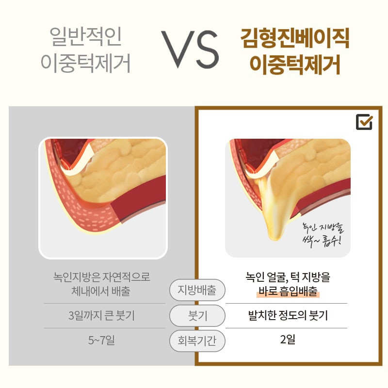 이중턱지흡으로 또렷한 턱선 만들고 싶다면 관련 이미지 5