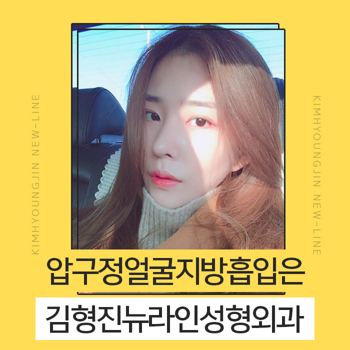 얼굴지방흡입전후 제대로 보려면 관련 이미지 1