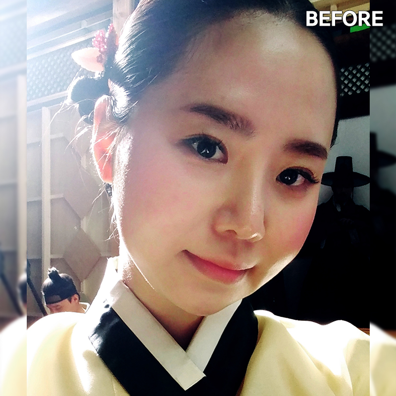 얼굴살빼는법! 전후 차이 확실하게 관련 이미지 2