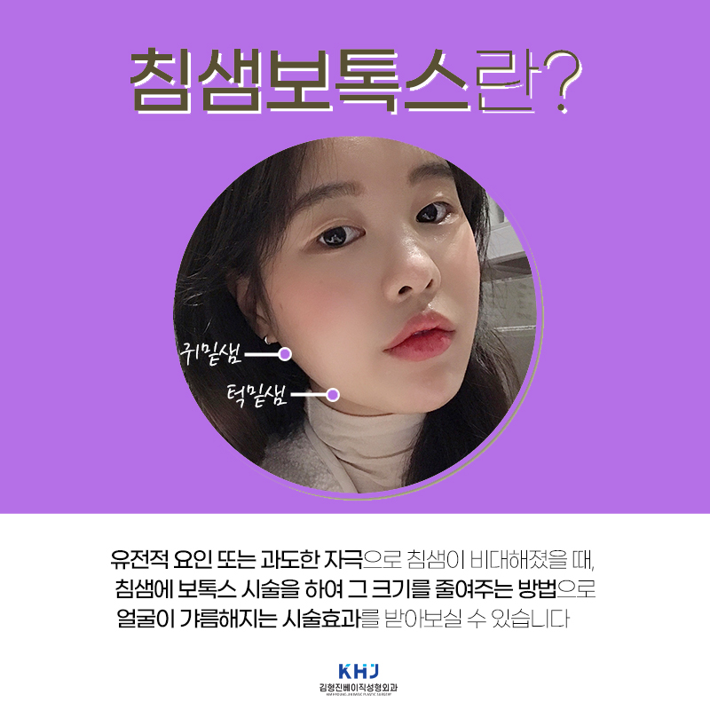 솔직한 압구정침샘보톡스후기 궁금하셨나요? 관련 이미지 4