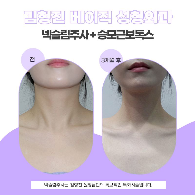 두꺼운목이 고민이라면 지금이 타이밍이에요 관련 이미지 5