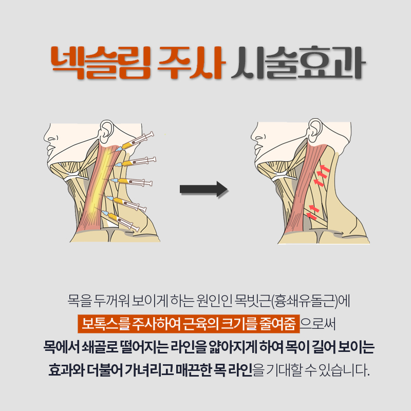 넥슬림주사시술로 얇고 여리여리한 목라인을 가지고 싶다면 관련 이미지 4