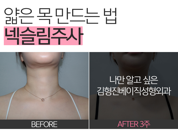 신부관리 이건 절대 빠질 수 없죠 관련 이미지 5