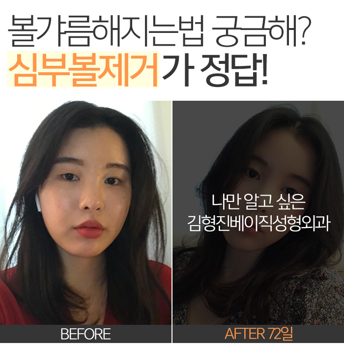 볼갸름해지는법 다 알고 있는데 관련 이미지 3