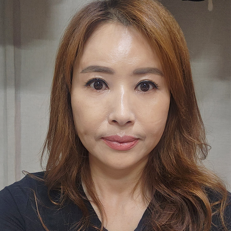 중년눈밑수술 김형진베이직에서 하셔야죠! 관련 이미지 1