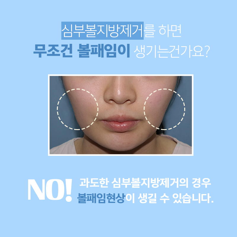 심부볼패임 너무 걱정된다구요? 관련 이미지 4
