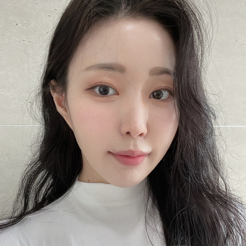 눈밑지방재배치수술 어떻게 진행되냐구요? 관련 이미지 5