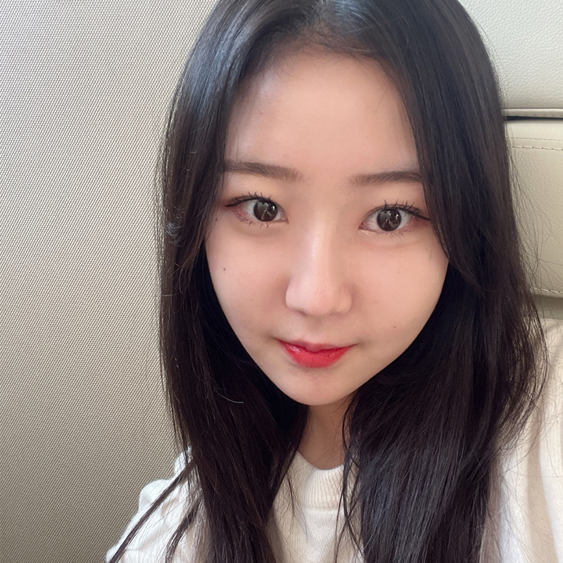 눈밑지방재배치회복기간 걱정하지 마세요 관련 이미지 6