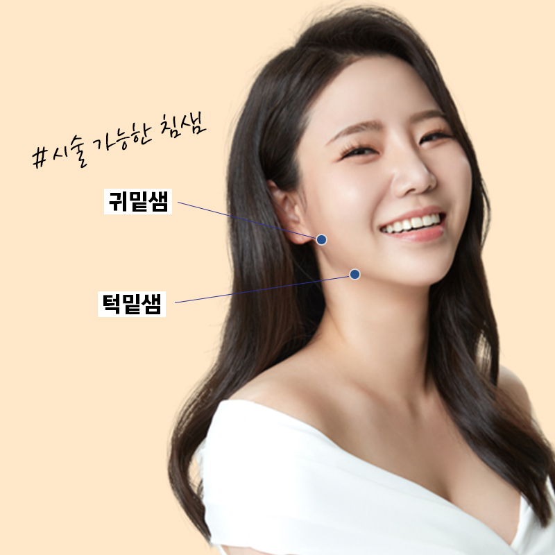 침샘비대증치료 이거 하나면 끝! 관련 이미지 2