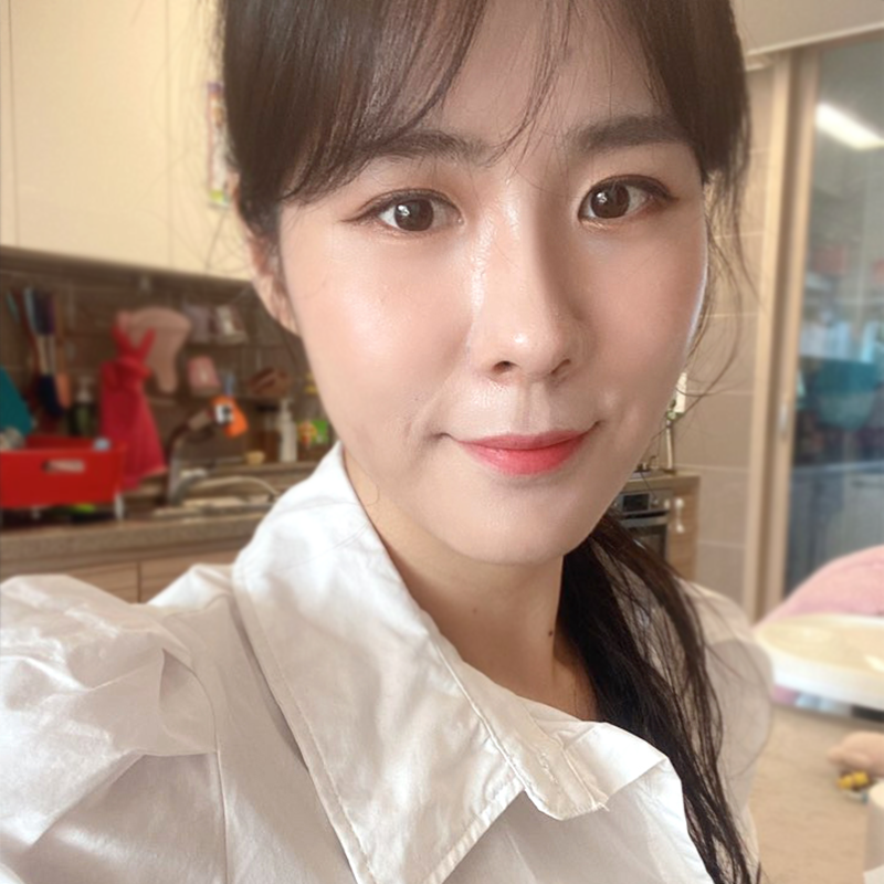 눈밑지방재배치재발? 김형진베이직에서는 걱정없어요 관련 이미지 2