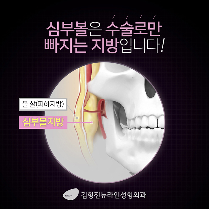 얼굴지흡 하기전에 이것부터 관련 이미지 3