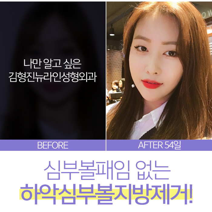 심부볼패임 무조건 온다고? 관련 이미지 7