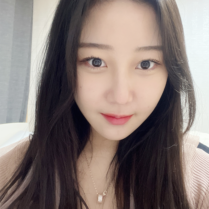 얼굴지방흡입전후 궁금한 사람 여기로~! 관련 이미지 6