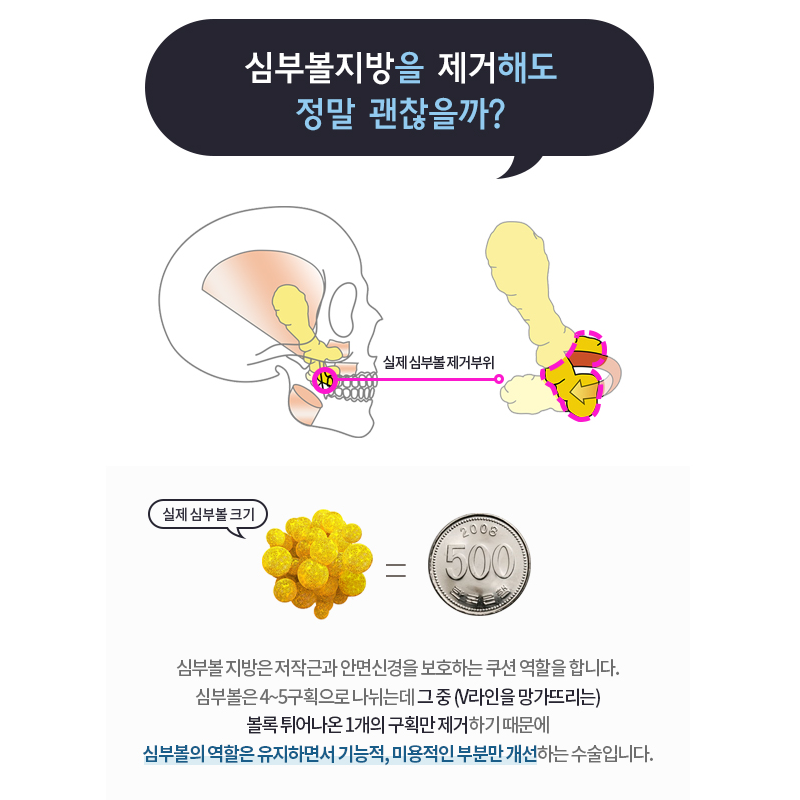 심부볼패임 걱정하실 필요 없는 이유 관련 이미지 2