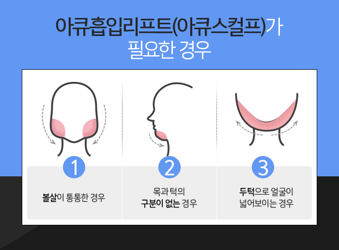 아큐스컬프 붓기 때문에 고민? 관련 이미지 5