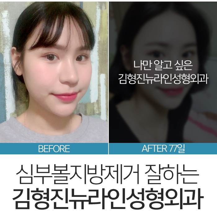 심부볼위치 정확하게 요기 관련 이미지 3