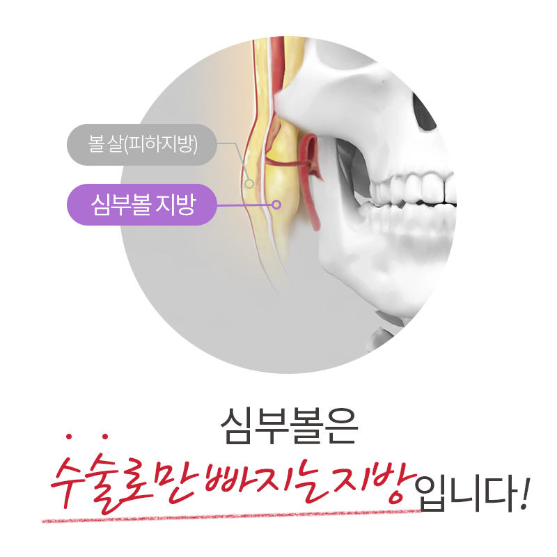 심부볼인모드로 가능할까요? 관련 이미지 2