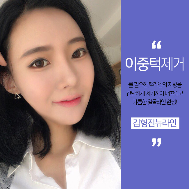 이중턱 살빼는방법 특별히 공개할께요 관련 이미지 1