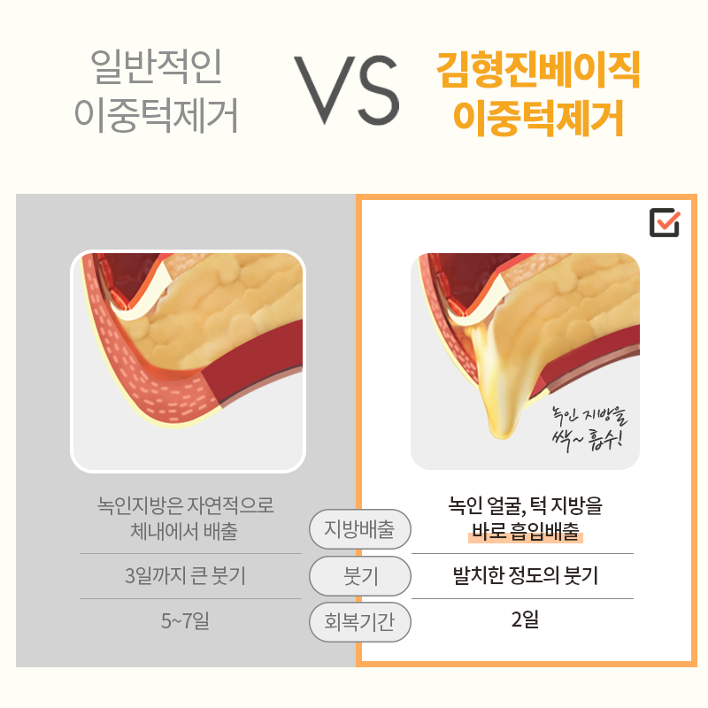 이중턱지방흡입효과 확실한 곳 여기에요! 관련 이미지 5