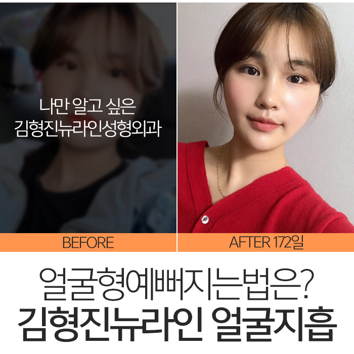 얼굴형예뻐지는법 확실한건 관련 이미지 3