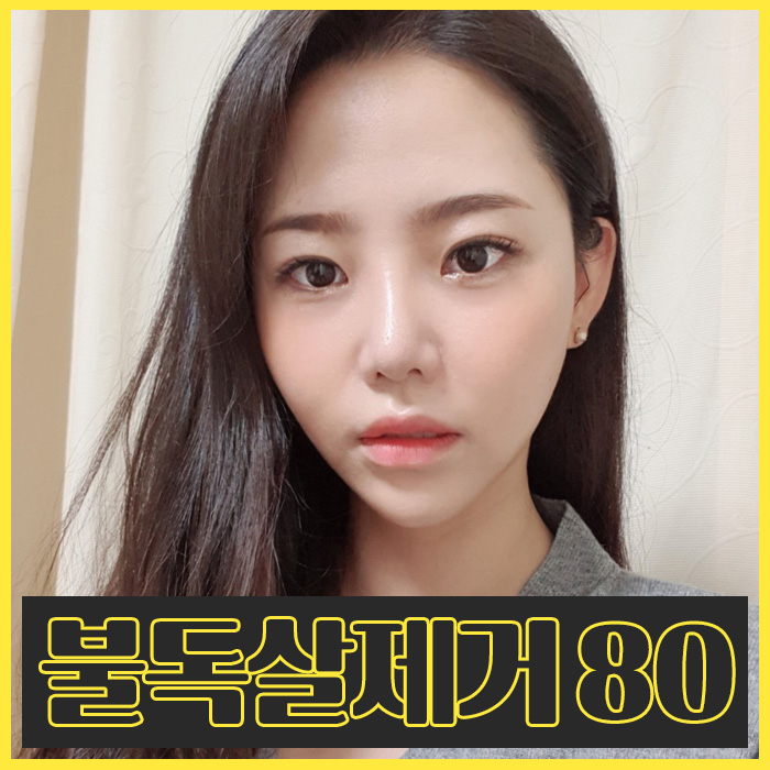 불독살 제거는 이 방법 뿐★ 관련 이미지 1