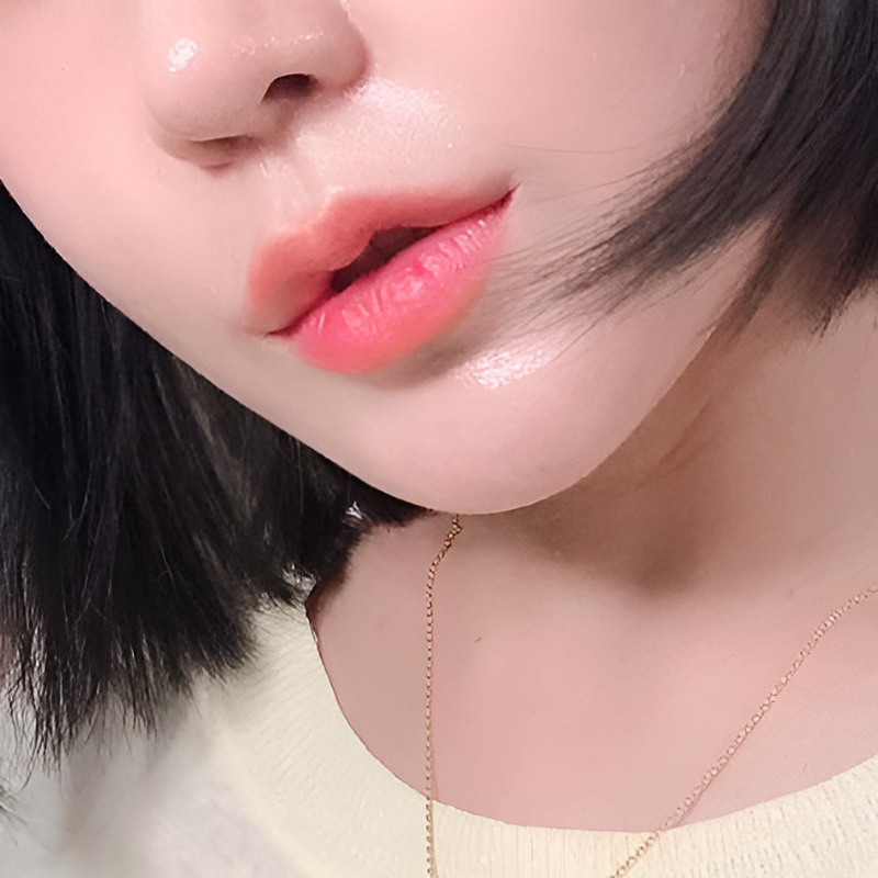 입꼬리필러시술로 자연스럽게 미소 띈 인상을 만들어요! 관련 이미지 3