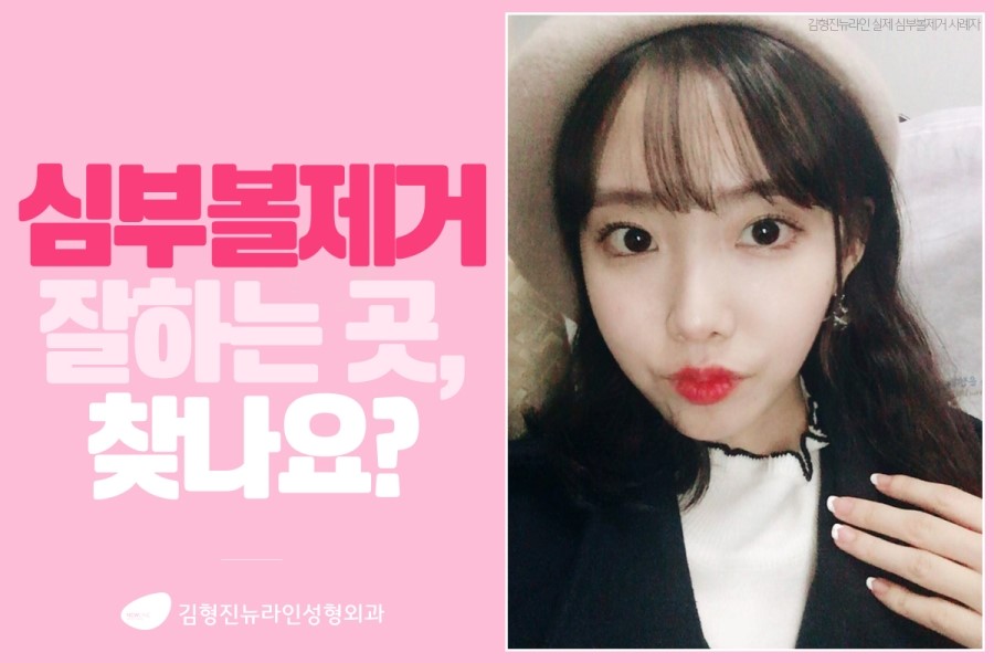 심부볼지방제거성형외과 김형진뉴라인, 알죠? 관련 이미지 1