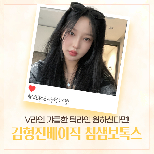 침샘보톡스효과 제대로 보고싶다면 들어오세요 관련 이미지 6