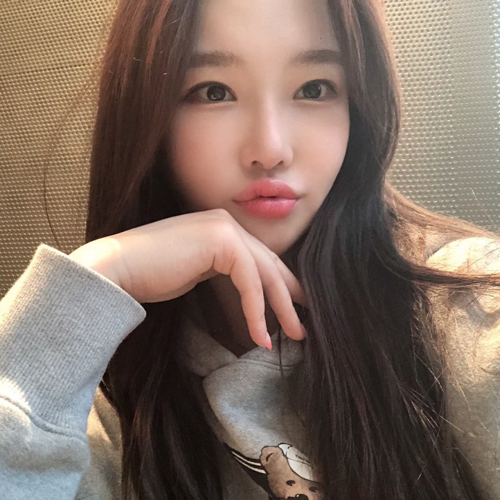 압구정입꼬리필러후기 이만큼 만족스러울 수가 없어요 관련 이미지 1