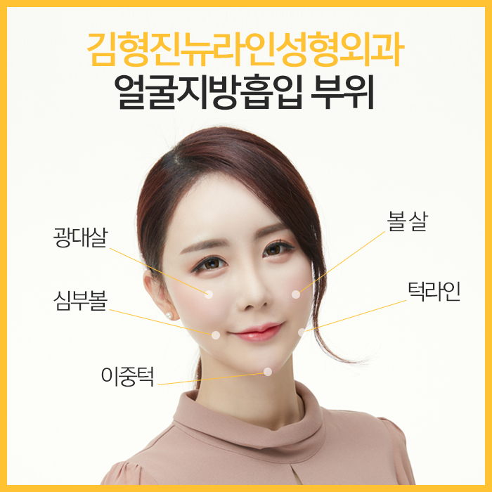 얼굴지방흡입붓기 요즘 누가 걱정해? 관련 이미지 5