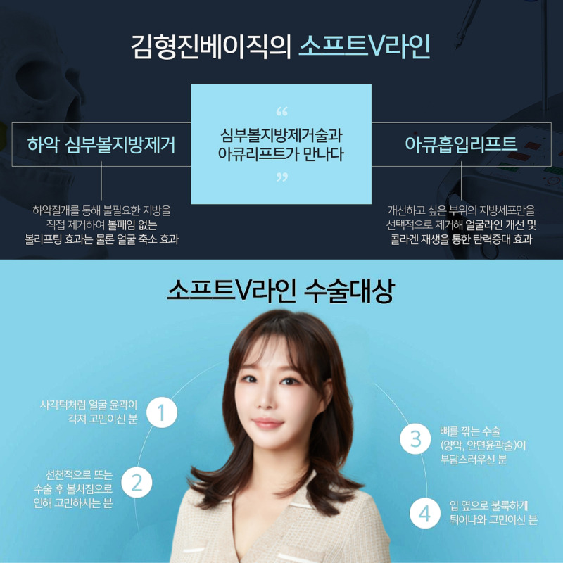 얼굴지흡수술 타고난 것처럼 자연스러운 브이라인을 원한다면 관련 이미지 3