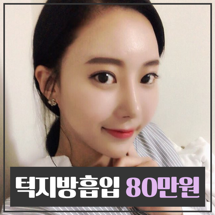 턱라인지방흡입 부담 없는 가격이죠 관련 이미지 1
