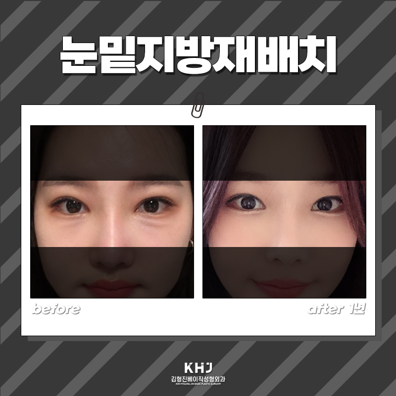 강남눈밑지 이제는 남자도 관리해야 되는 시대에요 관련 이미지 6