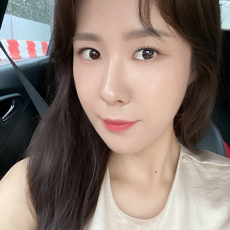 Why I Never Had to Go Back After Lower Eyelid Fat Removal image 6