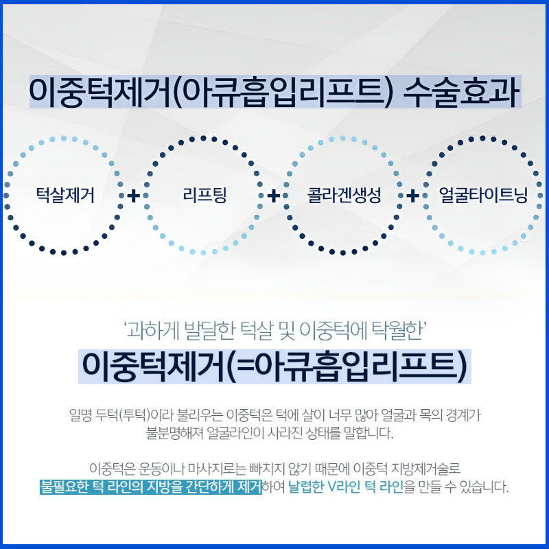 스트레스였던 턱살, 이중턱지방제거 하고 턱선 살아났어요 관련 이미지 4