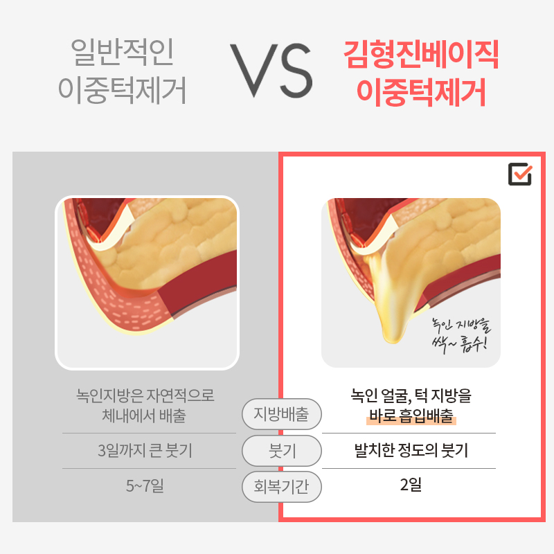 턱라인지방흡입 후기도 좋아 관련 이미지 4